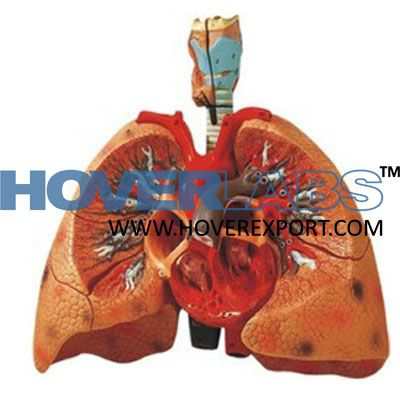 Heart With Lungs And Larynx